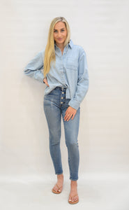 Axos Button Fly Skinny Hi